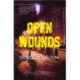 Open Wounds