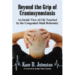 Beyond the Grip of Craniosynostosis: An Inside View of Life Touched by the Congenital Skull Deformity
