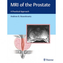 MRI of the Prostate: A Practical Approach