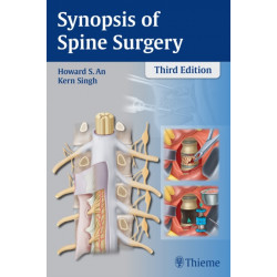 Synopsis of Spine Surgery