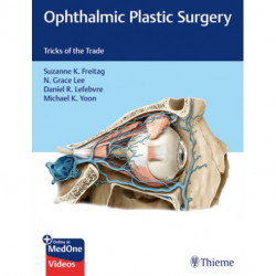 Ophthalmic Plastic Surgery: Tricks of the Trade