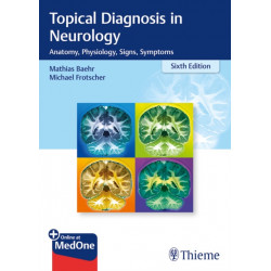 Topical Diagnosis in Neurology: Anatomy, Physiology, Signs, Symptoms