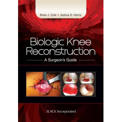 Biologic Knee Reconstruction: A Surgeon's Guide