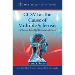 CCSVI as the Cause of Multiple Sclerosis: The Science Behind the Controversial Theory