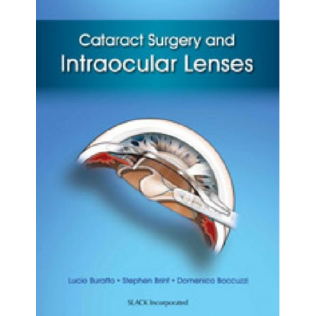 Cataract Surgery and Intraocular Lenses