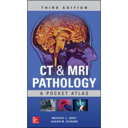 CT & MRI Pathology: A Pocket Atlas, Third Edition