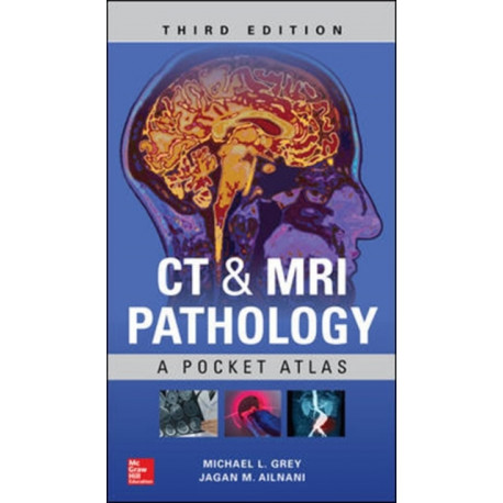 CT & MRI Pathology: A Pocket Atlas, Third Edition