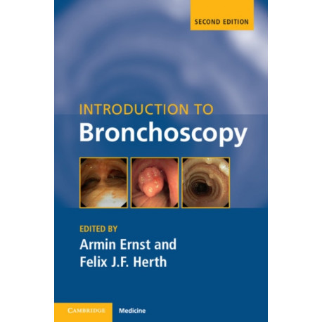 Introduction to Bronchoscopy