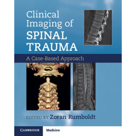 Clinical Imaging of Spinal Trauma: A Case-Based Approach