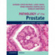 Pathology of the Prostate: An Algorithmic Approach