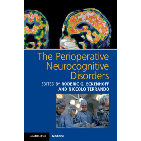The Perioperative Neurocognitive Disorders