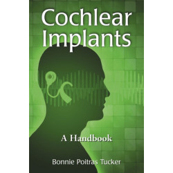 Cochlear Implants: A Handbook