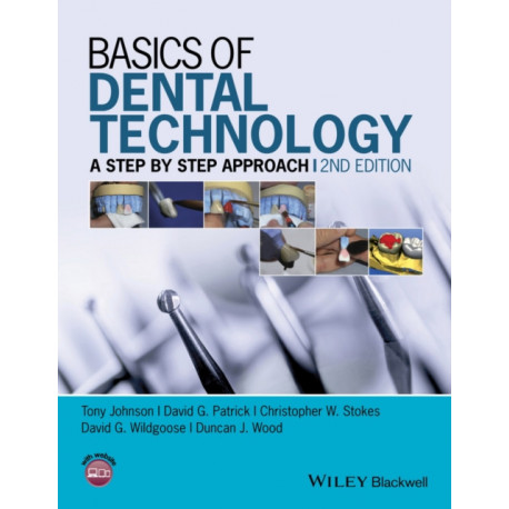 Basics of Dental Technology: A Step by Step Approach