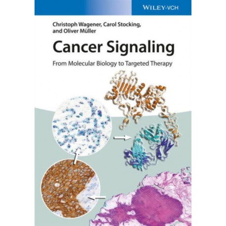 Cancer Signaling: From Molecular Biology to Targeted Therapy
