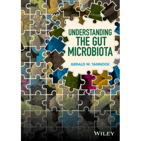Understanding the Gut Microbiota