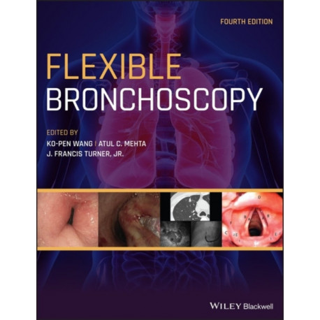 Flexible Bronchoscopy