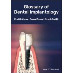 Glossary of Dental Implantology