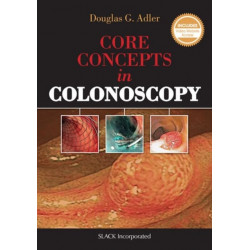 Core Concepts in Colonoscopy