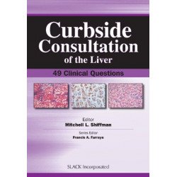 Curbside Consultation of the Liver: 49 Clinical Questions