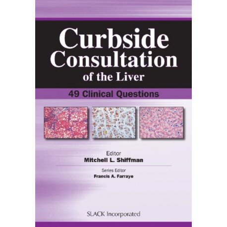 Curbside Consultation of the Liver: 49 Clinical Questions