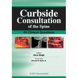 Curbside Consultation of the Spine: 49 Clinical Questions