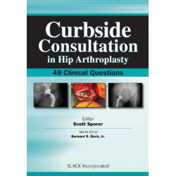 Curbside Consultation in Hip Arthroplasty: 49 Clinical Questions