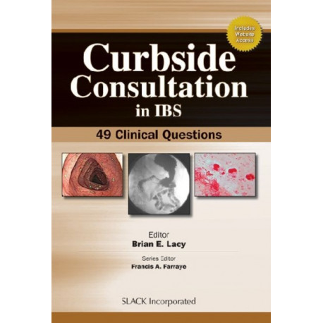 Curbside Consultation in IBS: 49 Clinical Questions