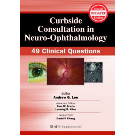 Curbside Consultation in Neuro-Ophthalmology: 49 Clinical Questions