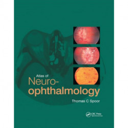 Atlas of Neuro-ophthalmology
